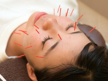 えんどう鍼灸接骨院の写真/お顔のくすみ・たるみケアに♪美容鍼のお得なクーポンをご用意◎お顔の筋肉やターンオーバーへアプローチ◎