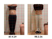 よしの鍼灸整骨院/産後骨盤矯正　　28歳　20回