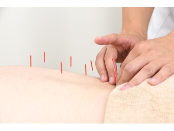 あさひろ鍼灸整骨院 新宿院の写真/【初回☆鍼+腰痛施術¥3980】腰の痛みでお悩みにはプロによる鍼灸×整体施術で徹底改善！新宿御苑前すぐ◎