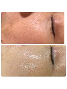 アイラッシュ ミル 御領店(eye lash Miru)/毛穴引き締め