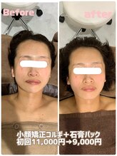 エリーザベル(Elisa Bell)/小顔矯正コルギ