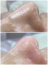 プアラ(puala)/つまりが取れて、つやつや！