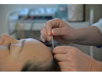 いろはり/施術風景2