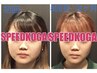 2回目来店【★1番人気★最高峰speed】プラチナ小顔矯正＋筋膜リリース