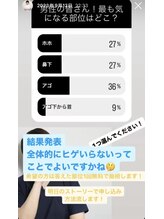 美容脱毛専門サロン エピラージュ 新宿店(Epilage)/髭剃り楽になりますよ！