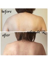 サロン ド アール(salon de R.)/【お背中骨氣・40代・施術効果】