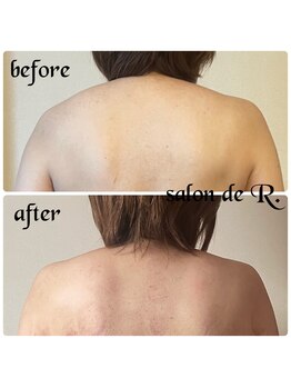 サロン ド アール(salon de R.)/【お背中骨氣・40代・施術効果】