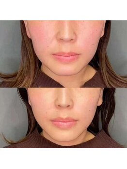 イーズン(Easen)/