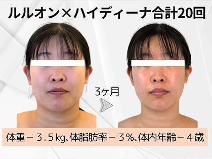 ヨサパーク ラ ペ(YOSA PARK La paix)の写真