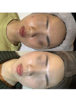 ルルアス(LuLu AS)/