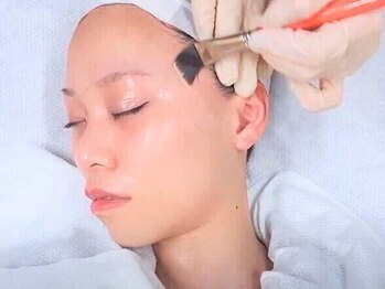 ルディラ 上野店の写真/医療提携★くすみ改善！医師監修美白ピーリング◎角質除去で速効トーンアップ効果も◎[ララピール￥7980]