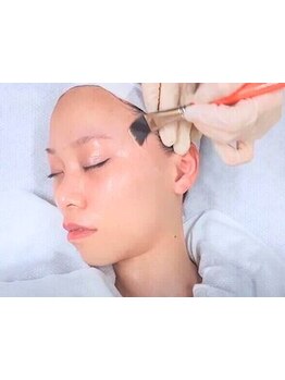 美白ケアをしたい