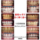 ホワイトニングショップ 宇都宮店