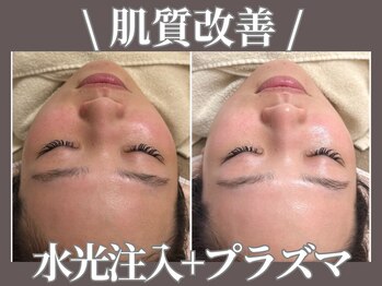 【肌管理×小顔・毛穴改善フェイシャルサロン】MavY.塚口店【3月 NEW OPEN(予定)】/リフトupもトーンupも保湿も☆