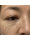 リボーン 柏(REBORN)の写真/【40代50代】夏の毛穴悩みに◎汗・皮脂・毛穴落ち対策なら柏の再生美容フェイシャルで毛穴レスな陶器肌に♪
