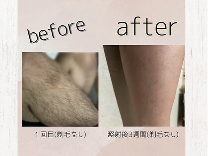 エレーヴ(Eleve)の写真