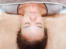 華藤 池袋店(KADOU)/小顔・美肌ケアには美容鍼