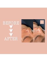 クリアラボ 豊中(Clear Lab)/Before&After