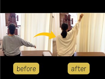 可児ボディーメイク接骨院/肩痛 (女性)