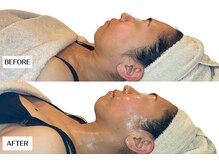 エングラッシー(en glassy)/BEFORE　AFTER　30代