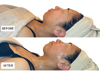 エングラッシー(en glassy)/BEFORE　AFTER　30代