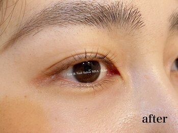 エムエスエー エクラ(MSA Eclat)/ナチュラルカール