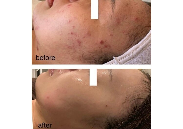 広島市南区で光フェイシャルが人気のエステサロン｜ホットペッパー