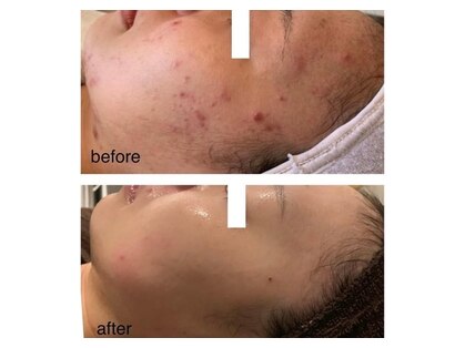 フェリーチェ(Felice)の写真