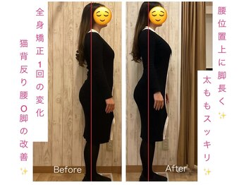 スピード小顔 渋谷店 (Speed)/全身矯正ビフォーアフター