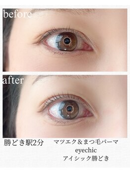 アイシック 勝どき(eyechic)/まつげパーマ/ラッシュリフト