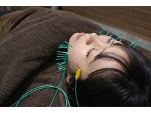 鍼灸リラクゼーションサロンLeafyの雰囲気(美容鍼でキレイになりたい方におすすめ◎)