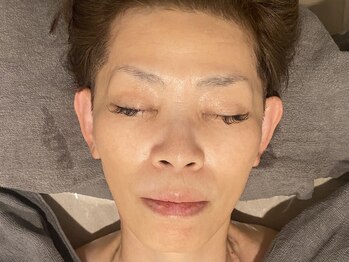 ラルミエール 緑店はなれ(la lumiere)/肌質改善!リゼネレート