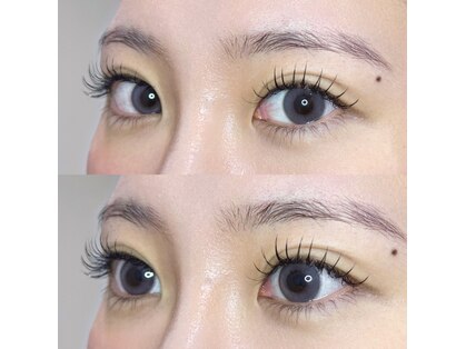 アリュールビューティー 下高井戸店(ALLURE BEAUTY)の写真