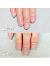 サロンペペ(salon pepe)/割れやすい爪にお悩みのお客様