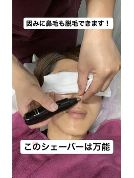 美容脱毛専門サロン エピラージュ 新宿店(Epilage)/鼻毛脱毛も可能!