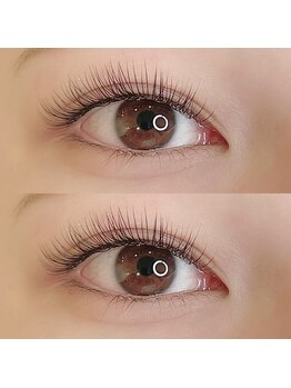 アネラ(anela)/パリエク120本