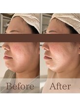 凪眠/小顔リンパフェイシャルの効果27