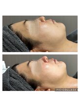 サイ(Sai)/ラミネーションピール