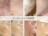 集中プログラムのお客様