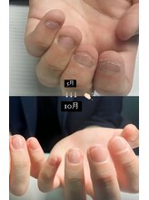 ネイルマン 横浜店(Nail Man)/自爪の育成/ビフォー＆アフター