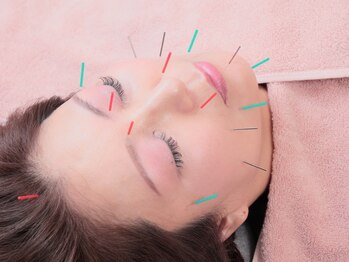 フワリ(FUWARI)の写真/【美容鍼でハリのある肌をつくりだす】大人女性を悩ませる、たるみ/ほうれい線のお悩み改善!うるおい補給♪