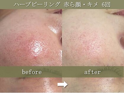 椿(TSUBAKI)の写真