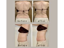 ココロミ(cocoromi)の雰囲気（最新型ハイパーナイフ７で結果の満足度UP!）