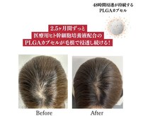 ララスマイル 鶴崎森町店/美髪プログラム(髪頭皮のお悩み)