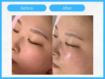 トウメイコガオ 横浜店/