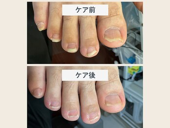 ルポ 伊勢/爪ケア