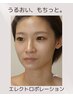 【乾燥・肌荒れ予防】】美容成分をたっぷり補給◎エレクトロポレーション