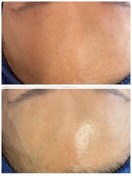 ビビィ(VIVIE)/一見キレイでも…