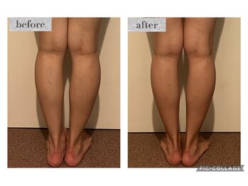 マンダ 田町(Manda)/引き締まったふくらはぎと足首に