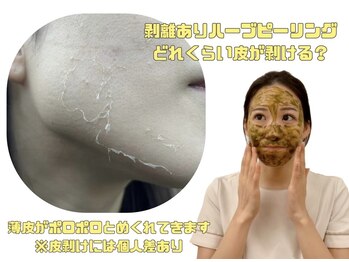 アイル 博多祇園店(iru)/剥離ありハーブピーリングのDT